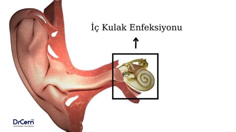 Labirentit Nedir Belirtileri Nedenleri Tedavisi Drcem