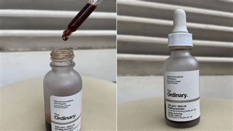 The Ordinary AHA BHA Peeling Solution: Pros And Cons