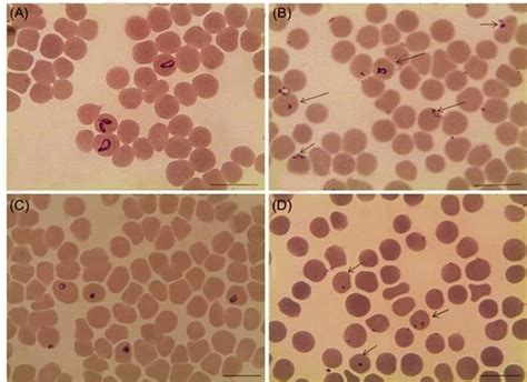 Light Micrographs Of Babesia Caballi And Theileria Equi Treated With 50