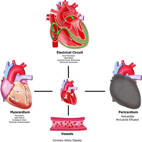 Clinical Subtypes Of Immune Checkpoint Inhibitor Induced Cardiovascular