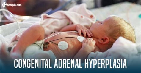 Congenital Adrenal Hyperplasia Newborn