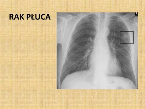 Rak P Uca Klasyfikacja Raki Niedrobnokom Rkowe A