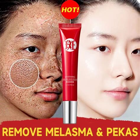 Effective Melasma Remover Cream Collagen Pekas Remover Original Dark