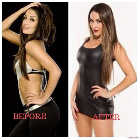 Nikki Bella Plastic Surgery Photos [Before & After] ⋆ Surgery4