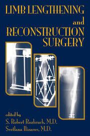 Limb Lengthening And Reconstruction Surgery S Robert Rozbruch Svet