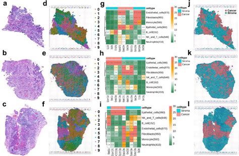 Integrating Microarray Based Spatial Transcriptomics And Single Cell