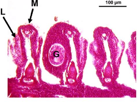 Encysted M. margaritifera glochidium in the gills of brown trout host ...