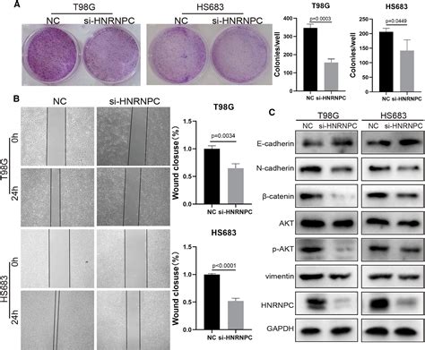 Lncrna Ddx11 As1通过与hnrnpc结合促进胶质瘤细胞的增殖和迁移