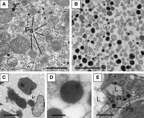 Peroxisome Electron Micrograph