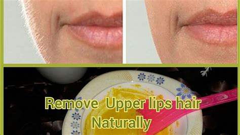 Remove Upper Lips Hair Naturally Permanently At Home Youtube