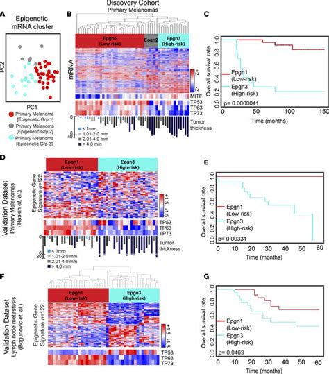 Jci Insight Transcriptional Dissection Of Melanoma Identifies A High