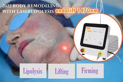 New 1470nm Diode Laser Equipment 6 In 1 For Micro Plastic Surgery