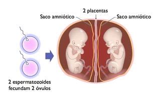 Como engravidar de gêmeos Tua Saúde