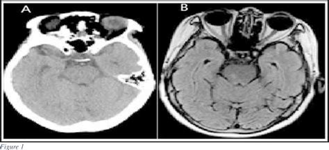 Figure 1 From Comparison Of The Values Of Computed Tomography And Magnetic Resonance Imaging In