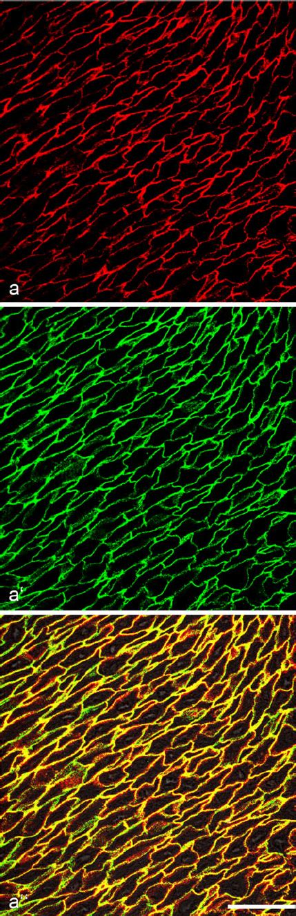 Double Label Confocal Laser Scanning Immunofluorescence Microscopy Of A