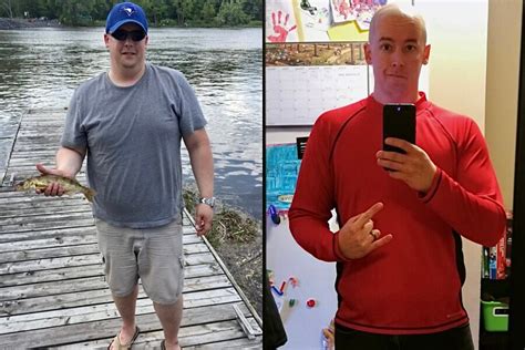 Ketogenic Diet Before After