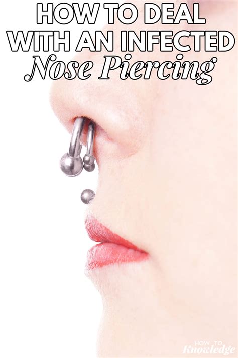 How To Deal With An Infected Nose Piercing