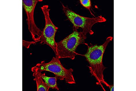 β Actin 8h10d10 Mouse Mab Cell Signaling Technology