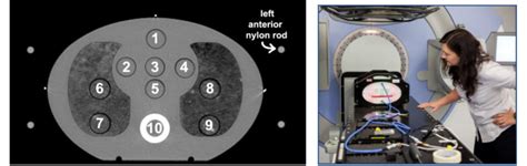 Cirs Thorax Phantom Left Ct Image Of Phantom At Central Location Download Scientific Diagram