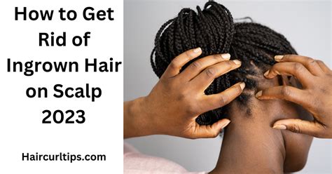 How To Get Rid Of Ingrown Hair On Scalp Comprehensive Guide 2023