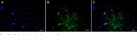 Figure From The Pathways By Which Mild Hypothermia Inhibits Neuronal