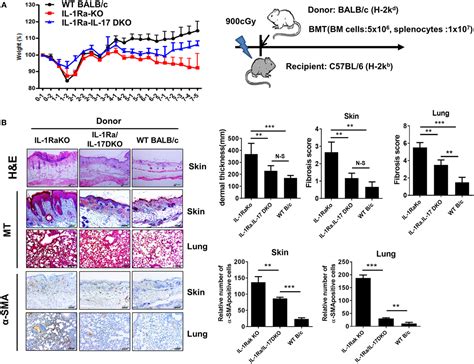 Frontiers Il 1 Il 17 Signaling Axis Contributes To Fibrosis And Inflammation In Two Different