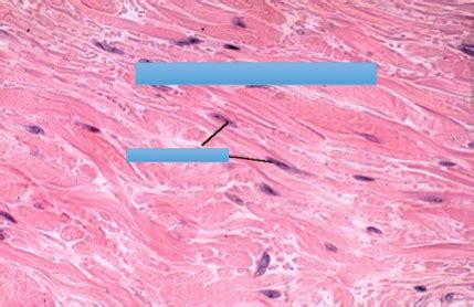 Connective Tissue Cells Histology Lab Flashcards Quizlet