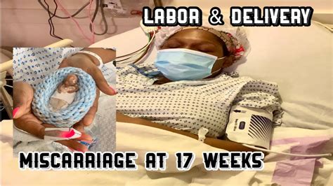 Labor And Delivery Miscarriage At Weeks Pregnant D C Surgery