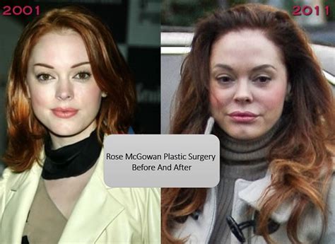 Rose McGowan Plastic Surgery Before And After Photos