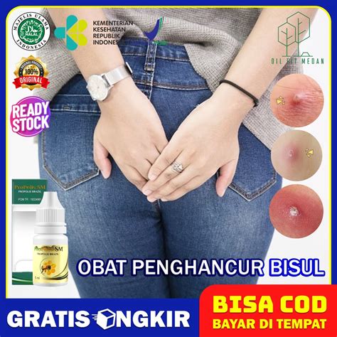 Jual Obat Bisul Pantat Alami Agar Cepat Pecah Bisul Pantat Biar Gak