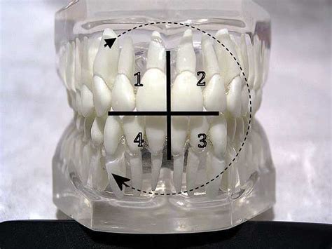 Fdi World Dental Federation Notation Wikiwand