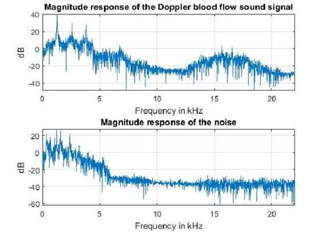 Doppler Blood Flow Sound And Interference Signal In Frequency Domain