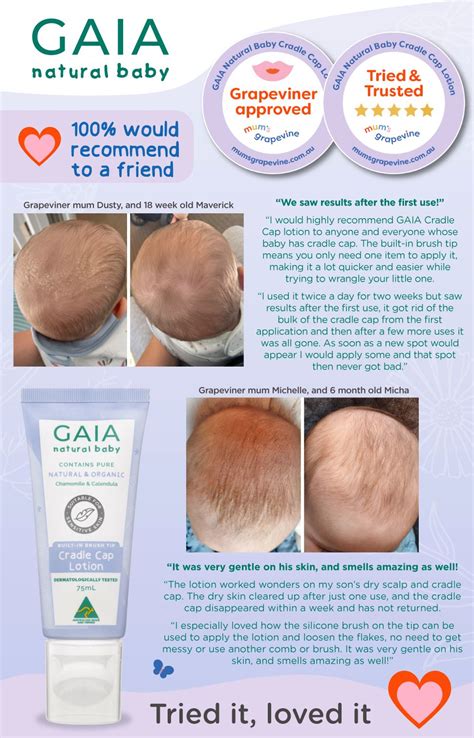 Buy Gaia Natural Baby Cradle Cap 75ml Online At Chemist Warehouse®