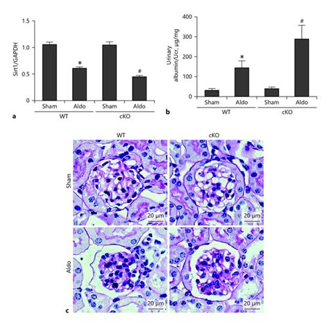 Deletion Of Sirt In Podocyte Aggravated Mtd Mitochondrial Morphology