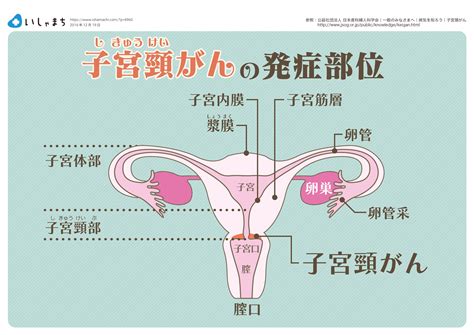 子宮頸がんの初期症状とは？ 早期発見は定期検診が決め手です！ ベテラン主婦と会社員の知恵袋