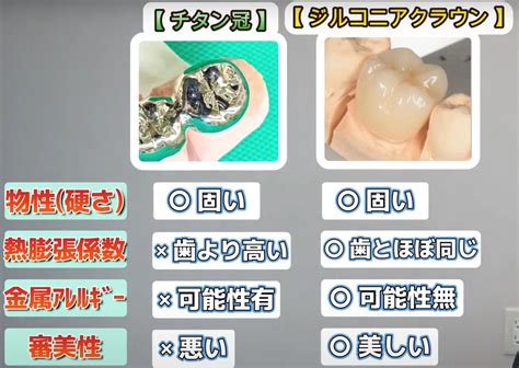 奥歯の被せ物は何がおすすめ？ジルコニアクラウンについて解説！ 浅賀歯科医院 医院ブログ