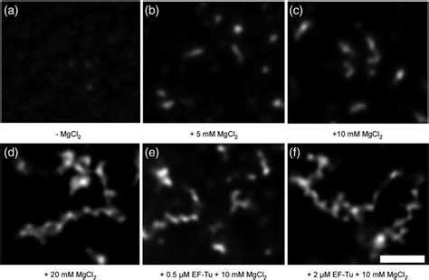 Fluorescence Micrographs Of Purified Yfp Mreb In Vitro On Glass Slides