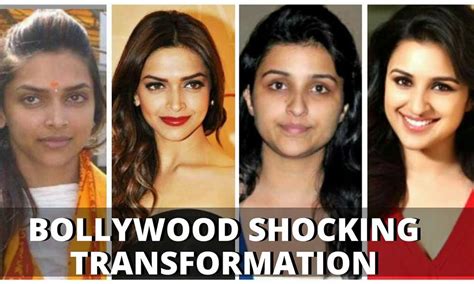 Sonam Kapoor Plastic Surgery