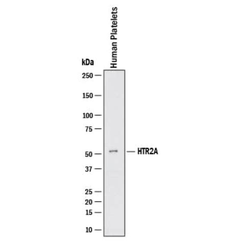 Human 5 HT2A Antibody Novus Biologicals 100 μg Unconjugated