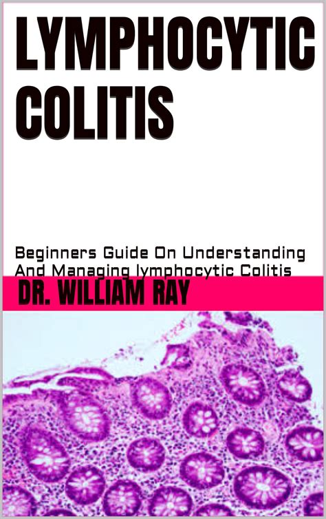 LYMPHOCYTIC COLITIS: Beginners Guide On Understanding And Managing ...