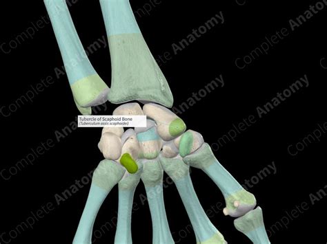 Tubercle of Scaphoid Bone | Complete Anatomy