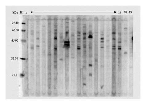 Western Blot Reactivity Of Human Sera With Membrane Proteins Isolated