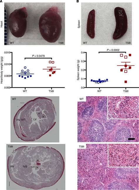 Organ Enlargement In 6 To 8 Month Old Kras T58i Mice A Gross