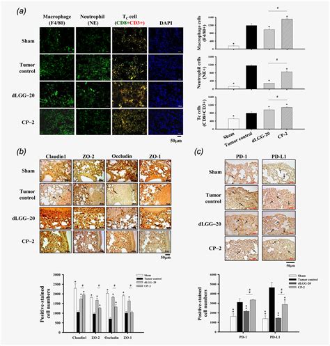 Plant Galactolipid DLGG Suppresses Lung Metastasis Of Melanoma Through