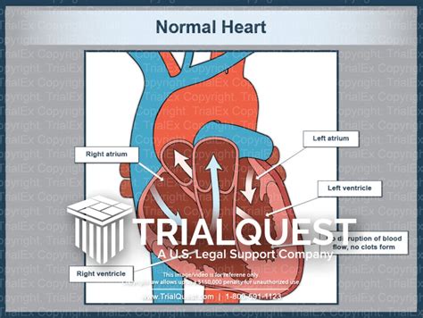 Normal Heart - TrialExhibits Inc.