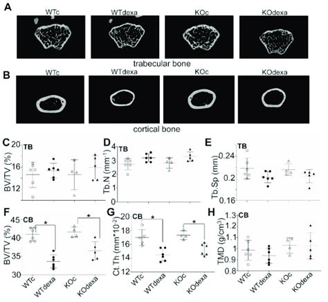 MicroCT Analysis Of Distal Femurs In Male Mice Representative 2D