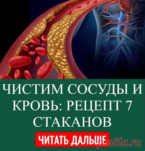 ЧИСТИМ СОСУДЫ И КРОВЬ РЕЦЕПТ 7 СТАКАНОВ Мода Постила