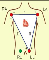 Intro To Ekg Flashcards Quizlet