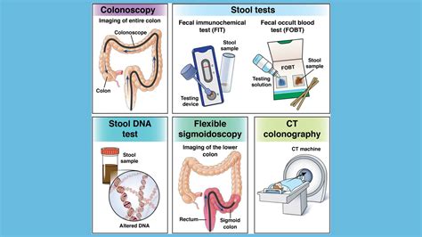 Talking To Your Patients Colorectal Cancer Screening Starts At Age 45