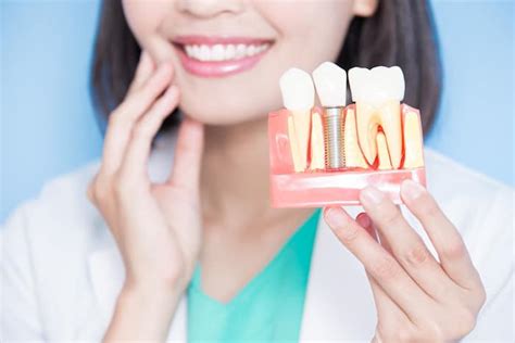 The Pros And Cons Of Dental Implants Vs Bridges